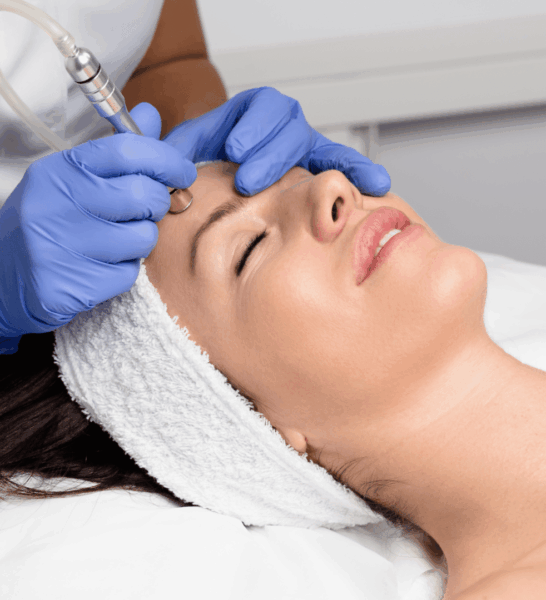 Diamant Mikrodermabrasion Gesichtsbehandlung zur Hauterneuerung und Verfeinerung des Hautbildes im Kosmetikstudio Venus Geiselhöring